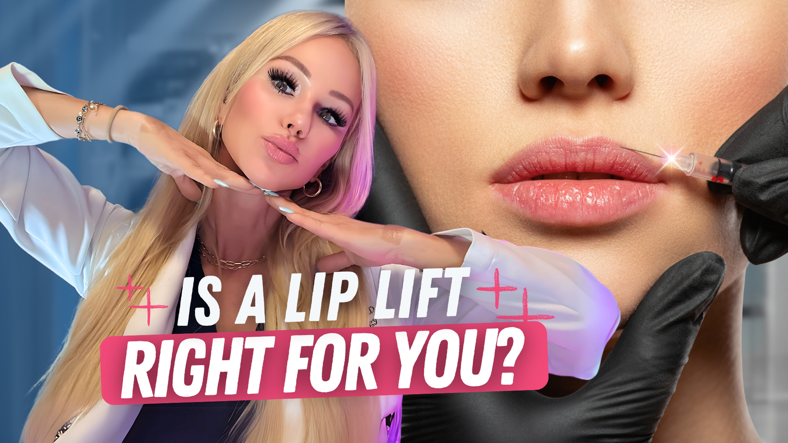 Is Lip Lift Surgery Right for You? What to Know About Lip Flips, Fillers & Facial Aging