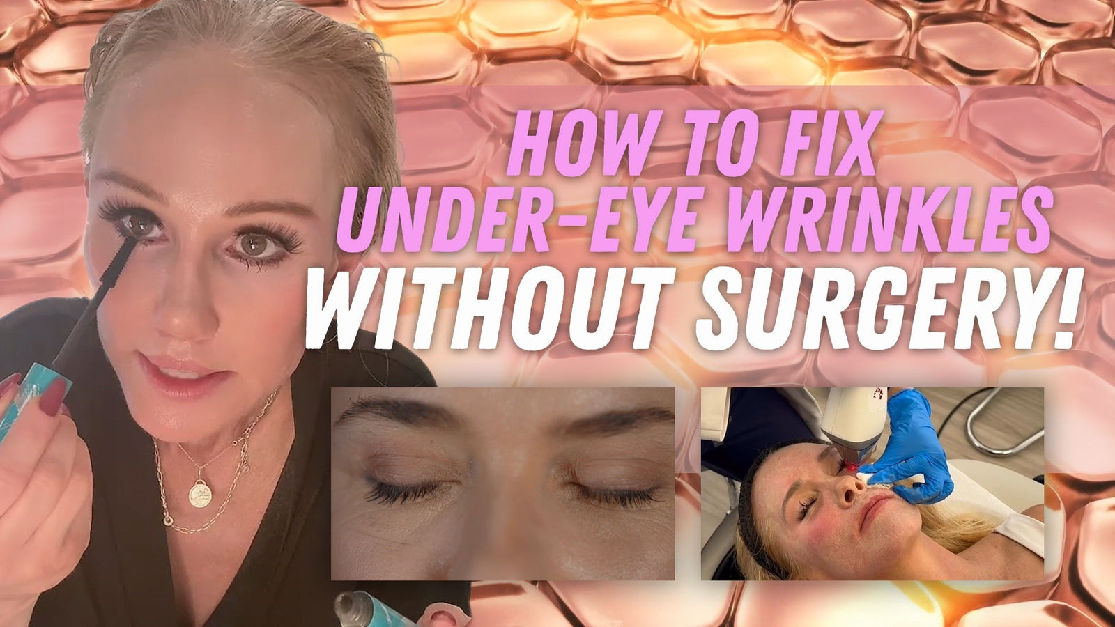 Smooth, Bright, and Tight: Tackling Under-Eye Fine Lines