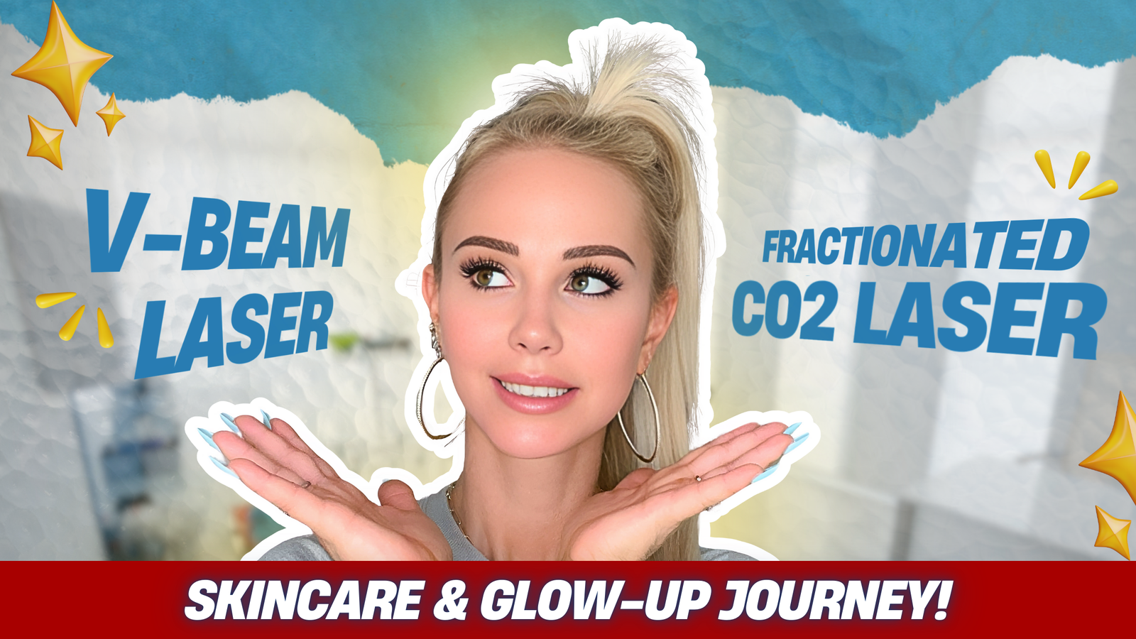 My CO2 & Vbeam Laser Experience: Preparation, Recovery, and Results