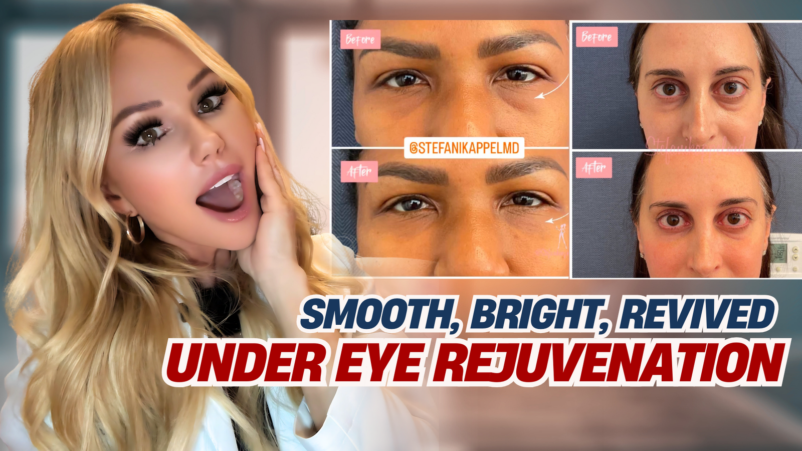The Ultimate Guide to Under Eye Rejuvenation